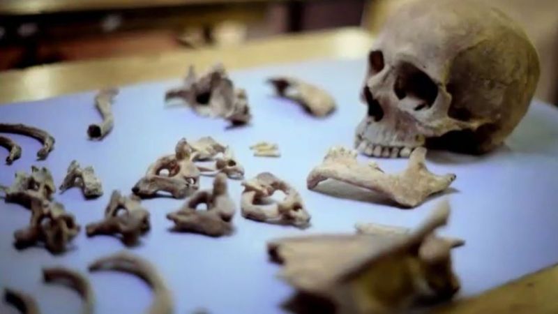 "Temos vários registros históricos de violência contra os judeus por volta de 1190 em Londres e nas outras cidades do reino", resume o pesquisador, que integra o Departamento de Ciências da Terra do Museu de História Natural, localizado na capital britânica. Um dos locais onde esses episódios aconteceram foi justamente Norwich. As primeiras informações sobre as ondas de violência contra o povo judeu por lá vêm do ano de 1144, desencadeadas pelo assassinato de um menino chamado William. À época, a família dele acusou alguns membros da comunidade judaica local como os responsáveis pelo crime. Essa, aliás, foi a primeira vez na história em que há registros sobre o mito do libelo de sangue, uma alegação absolutamente falsa de que os judeus matam crianças cristãs para usar o sangue delas em rituais. Essa teoria da conspiração antissemita, aliás, persiste até os dias de hoje. Mas o que isso tem a ver com os corpos encontrados nas escavações do shopping? Os estudos de datação de carbono-14 indicam que esses indivíduos foram assassinados nessa mesma época, provavelmente entre os anos 1161 e 1216 — o que sugere que eles podem ter sido vítimas dessa onda de ataques. "A possibilidade de que os restos humanos encontrados no poço próximo ao shopping estão relacionados à violência antissemita é ainda sustentada pelo fato de o local estar ao sul de onde ficava o bairro judeu medieval da cidade", aponta o artigo. Um registro feito pelo cronista e decano Ralph de Diceto naquelas décadas aponta que "em 6 de fevereiro [de 1190] todos os judeus encontrados em suas casas em Norwich foram massacrados; alguns se refugiaram no castelo". Rei Guilherme I CRÉDITO,GETTY IMAGES Legenda da foto, O rei Guilherme I convidou os judeus da Europa continental a criar assentamentos na Inglaterra A análise publicada recentemente pelos especialistas foi capaz de descobrir que três das vítimas eram irmãs — uma jovem adulta, outra com idade entre 10 e 15 anos e a terceira com 5 a 10 anos. Elas tinham olhos castanhos e cabelo escuro. O quarto esqueleto era de um menino ruivo de olhos azuis com menos de três anos. O achado é significativo, uma vez que essas características físicas eram muito associadas aos judeus nesse período da história. Para completar o grupo, o quinto indivíduo era adolescente e o sexto, um homem adulto. Não se sabe exatamente como todos foram assassinados, mas não há dúvidas entre os especialistas de que houve alguma violência envolvida. O segredo escondido nos genes E como os cientistas conseguiram determinar que os esqueletos eram mesmo de judeus asquenazes? É aí que entra mais uma vez o sequenciamento genético e a comparação das informações do DNA das vítimas com o genoma de pessoas dessa comunidade que vivem até hoje. "Que fique claro: não existem testes genéticos que determinam se alguém é judeu ou de qualquer outra etnia", esclarece Thomas. "O que podemos afirmar com uma relativa certeza é que esses indivíduos encontrados na escavação se assemelham geneticamente ao que observamos no DNA dos judeus asquenazes vivos hoje", complementa. E essa pesquisa ajudou, inclusive, a entender a origem de algumas doenças que são mais comuns nessa população. "Conseguimos encontrar variantes genéticas associadas a enfermidades que aparecem com maior frequência em judeus asquenazes", conta o acadêmico. Entre as mutações, destacam-se algumas que aumentam a propensão a alguns tipos de tumores e atrasam o início da puberdade. Vale dizer que encontrar uma presença mais frequente de certos problemas de saúde em algumas etnias é comum — alguns povos da África Central são mais acometidos pela anemia falciforme (doença hereditária que altera os glóbulos vermelhos), enquanto as populações do Oriente Médio sofrem mais com a beta talassemia (anemia causada por uma mutação genética), por exemplo. Conhecer a fundo as origens e o que elas podem significar para a saúde, inclusive, é um ponto-chave para melhorar o diagnóstico e descobrir novos tratamentos para essas doenças. Um rosto reconstruído de um adulto do sexo masculino (esquerda) e uma criança (direita) com base em restos esqueléticos CRÉDITO,PA MEDIA/PROF CAROLINE WILKINSON Legenda da foto, Baseado nas informações disponíveis, os cientistas reconstruíram o rosto de duas das vítimas: um adulto e uma criança Thomas explica que, muitas vezes, essa maior frequência de um problema ou outro tem a ver com um fenômeno conhecido na genética como "efeito de gargalo". Ele acontece quando o tamanho de uma população é severamente diminuído. Daí, os indivíduos sobreviventes carregam genes que acabam se perpetuando e passando para as próximas gerações. Com isso, quando aquele grupo volta a crescer nas gerações seguintes, uma maior taxa deles pode possuir certas alterações no DNA. As ondas de violência que acometeram os judeus asquenazes desde 70 d.C. até o século 12 podem ter diminuído significativamente essa população em vários períodos da história. As pessoas que sobraram desses massacres formaram novas famílias e perpetuaram características genéticas que foram mantidas mais frequentemente nas gerações seguintes, até chegar aos descendentes vivos hoje em dia. "Antes, acreditava-se que esse efeito de gargalo entre os judeus asquenazes teria se passado nos últimos 800 anos. Nosso trabalho testou esses limites e aponta que isso ocorreu em períodos anteriores", diz Thomas. Esse efeito de gargalo, porém, teria acontecido após a separação entre os judeus asquenazes e os sefarditas, advindos do norte da África e da Península Ibérica. Isso porque essas mutações genéticas observadas nas vítimas de Norwich não são encontradas na mesma frequência entre os sefarditas. A possibilidade de estudar os restos mortais desses indivíduos surgiu quando os esqueletos precisaram ser transferidos de local no cemitério onde estavam — as leis judaicas proíbem a exumação dos corpos por vários motivos. "O rabino-chefe de Norwich nos avisou que os esqueletos precisavam ser movidos para uma nova área do cemitério, o que nos permitiu coletar mais algumas amostras para realizar os estudos com as tecnologias avançadas que dispomos hoje", relata Barnes. Terminada a pesquisa, o biólogo molecular avalia que o trabalho ajudou a resolver "um crime misterioso" que perdurava há séculos. "E isso é particularmente importante para que a comunidade conheça, entenda e reflita sobre as suas origens", conclui.